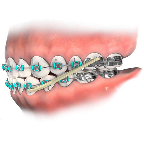 American Orthodontics