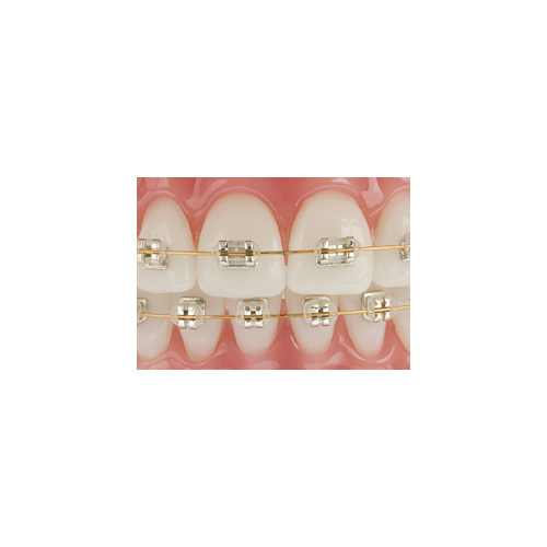 American Orthodontics