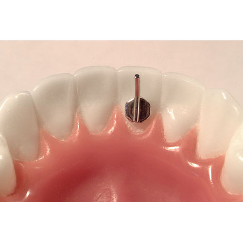 American Orthodontics