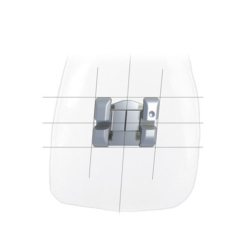 Master Series Brackets