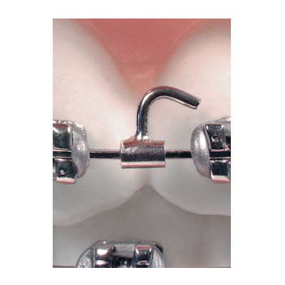 American Orthodontics