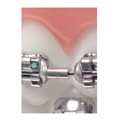 American Orthodontics