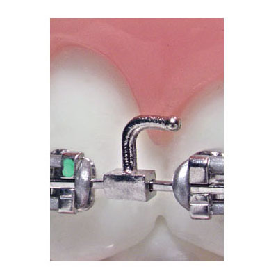 American Orthodontics