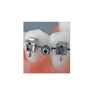 American Orthodontics