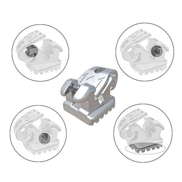 American Orthodontics